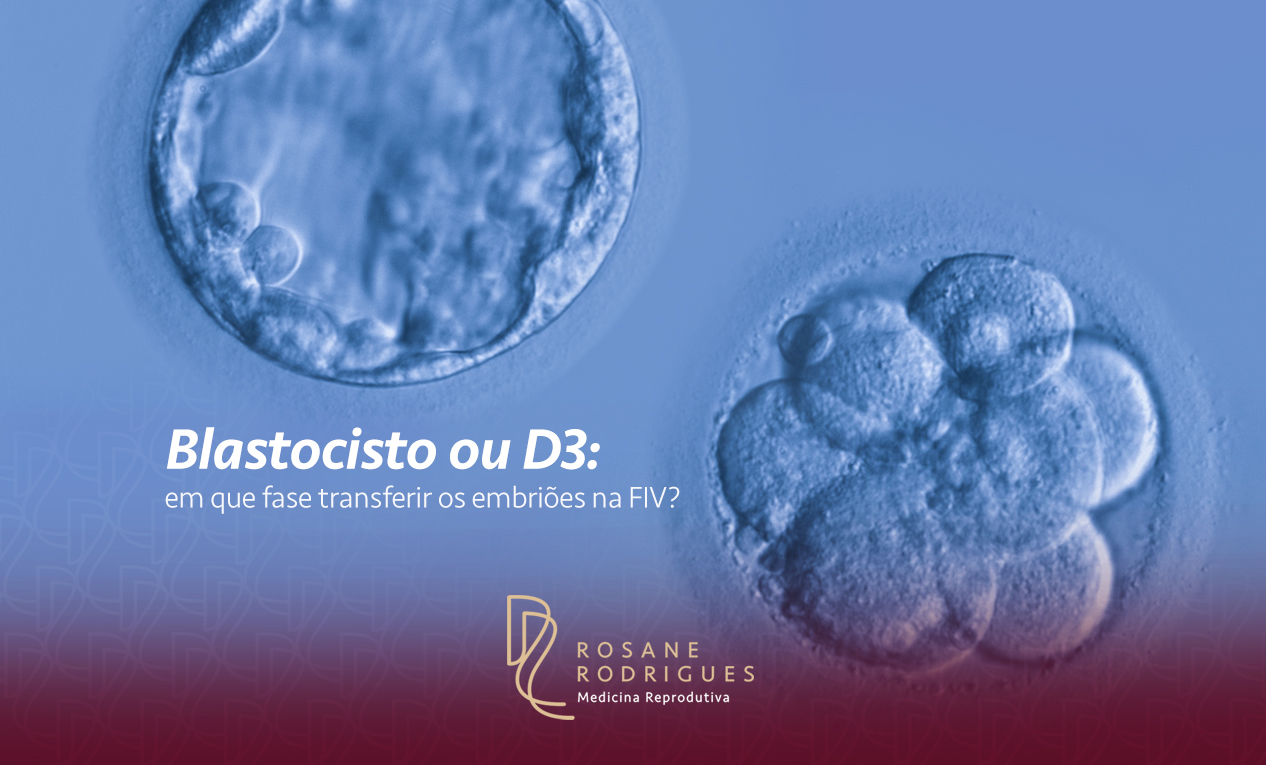 Blastocisto ou D3: em que fase transferir os embriões na FIV?