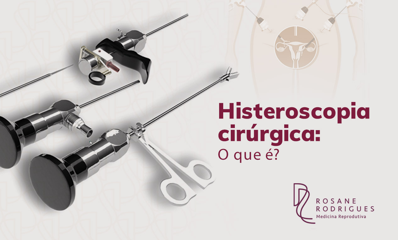 Histeroscopia cirúrgica: o que é?
